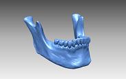 Laser Scanning anatomic Jaw