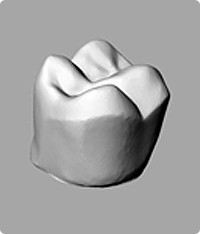 Laser Scanning Small Tooth